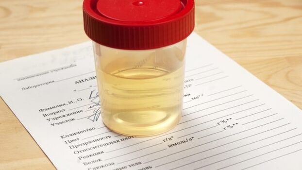 Urinanalyse fir arteriell Hypertonie